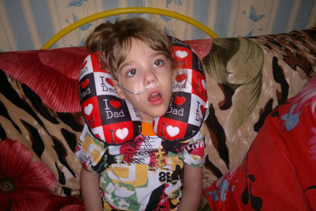 Дорогое лекарство поможет ребенку с эпилепсией в Новосибирске