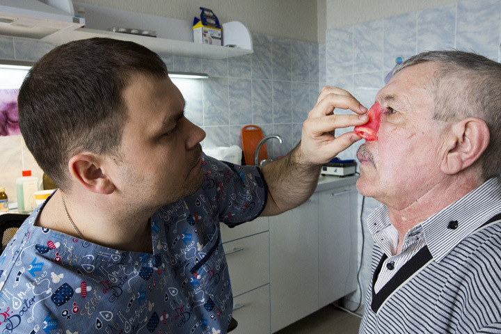 «Либо нос, либо жизнь»: как в Сибири делают новые лица для победивших рак