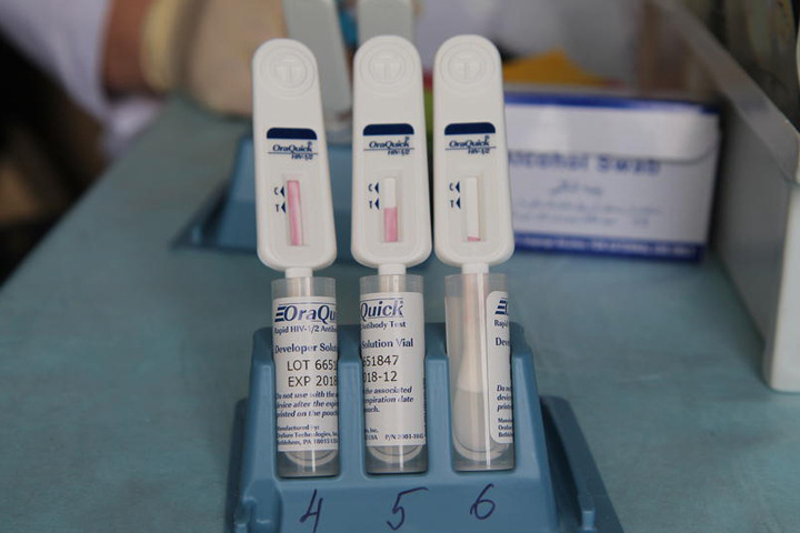 Каждый двадцатый тест новосибирцев на ВИЧ оказался положительным