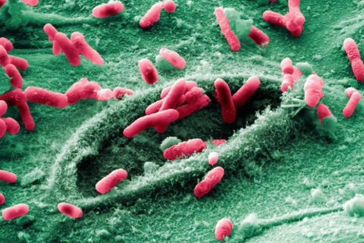 Выделенные из бактерий наночастицы в два раза ускоряют заживление ожогов