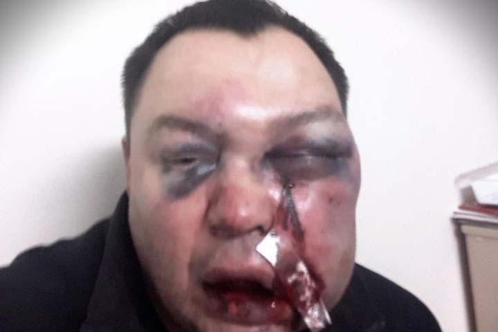 Экс-депутат КПРФ избит в Иркутской области