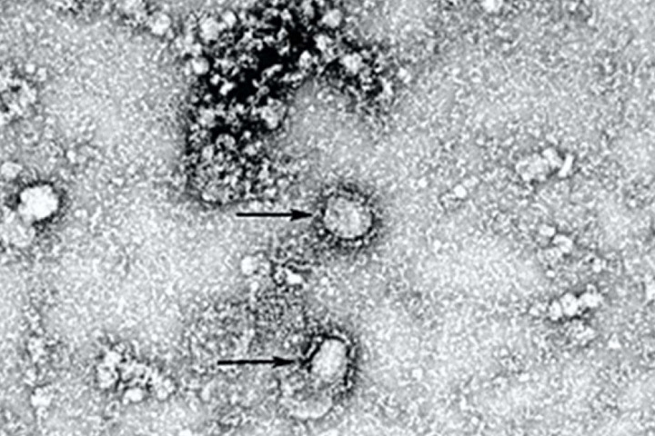 Новосибирские тесты на коронавирус раздали другим странам