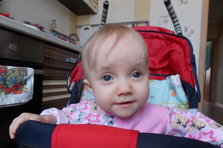 Пережившей 15 переломов малышке из Новосибирска нужно лекарство, чтобы ходить