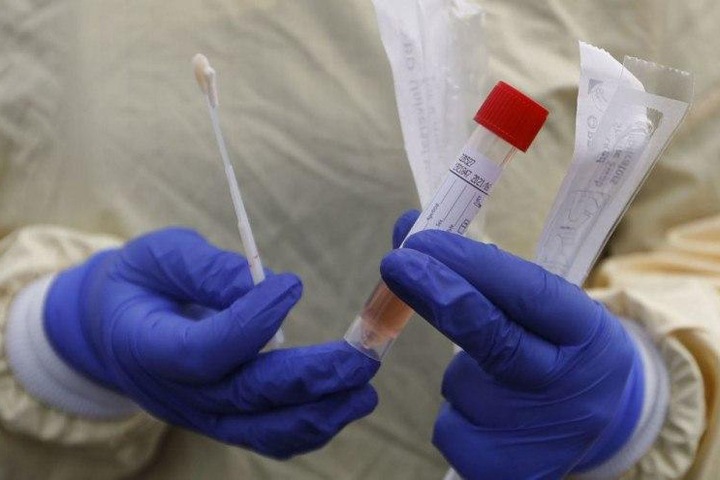 Еще пять новосибирцев умерли от коронавируса
