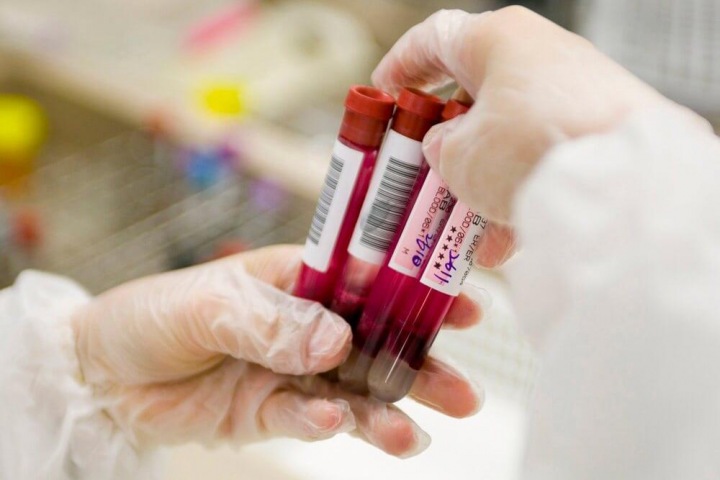 Лесосибирцы пожаловались на перенос СПИД лаборатории в общую поликлинику из-за коронавируса