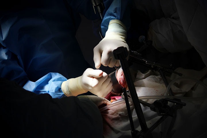 Главного хирурга новосибирской больницы судят за стимулирующие выплаты на 38 тыс.