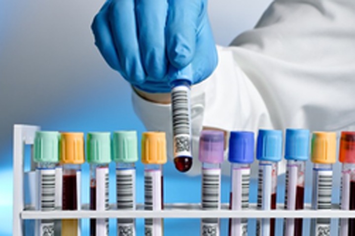 Новосибирцам предлагают тест на эффективность «работы» антител к коронавирусу