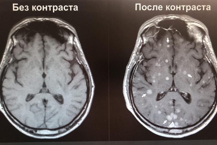 Новосибирские ученые разработали нетоксичные контрастные реагенты для МРТ-исследований