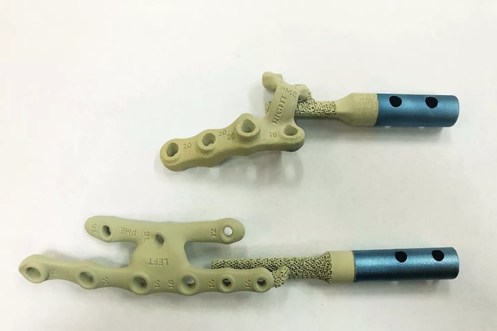 Напечатанные на 3D-принтере имплантаты от томского вуза вдвое ускоряют заживление переломов