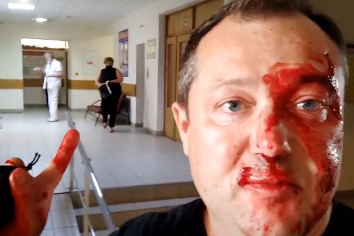 Выдвинувшегося в красноярский парламент журналиста избили в избиркоме