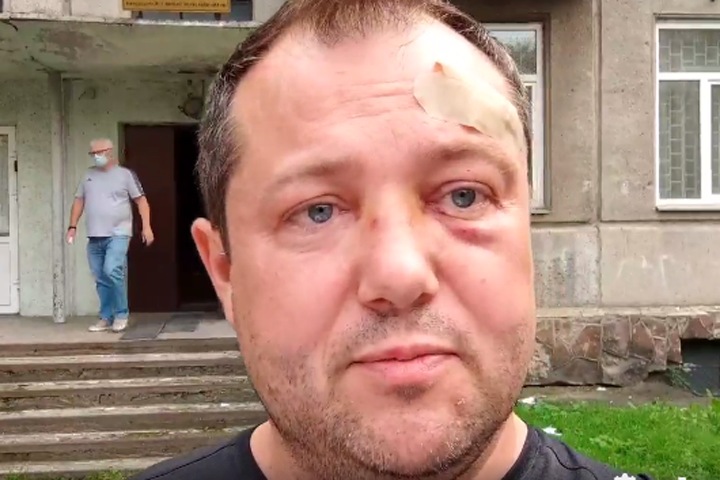 Дело о нападении на кандидата в красноярский парламент передали в СК