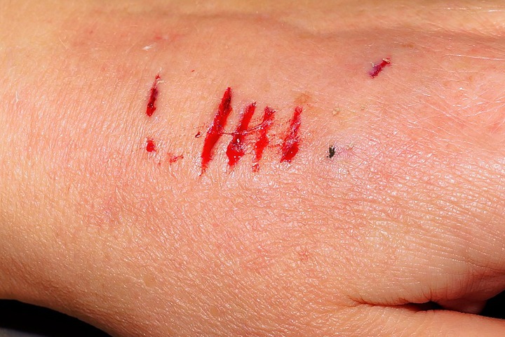 Женщина укусила и поцарапала полицейского в детской поликлинике Иркутска
