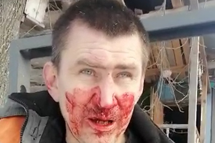 Кузбасский экоактивист рассказал, что его избили приехавшие с экс-депутатом мужчины