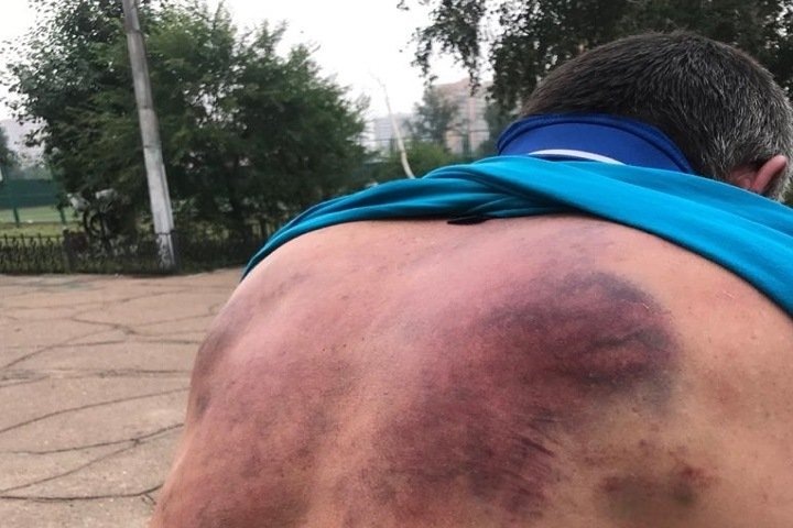 Пропал рассказавший об избиении росгвардейцами и угрозах изнасилованием житель Улан-Удэ