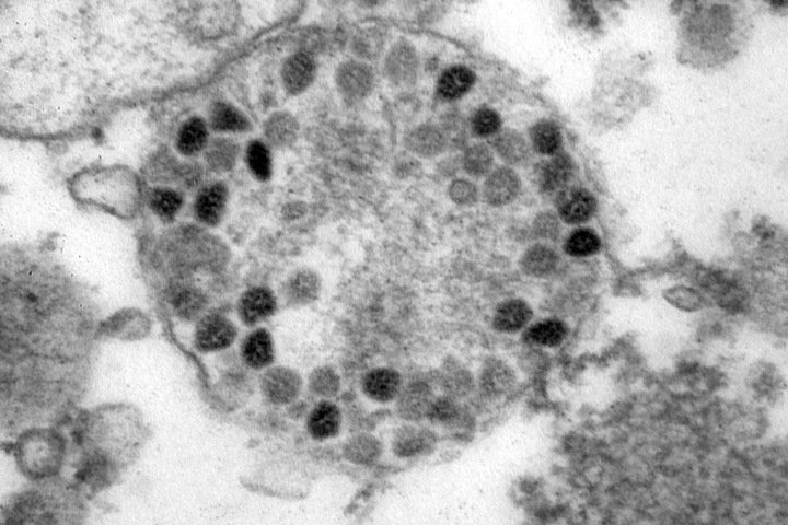 Омикрон-штамм коронавируса обнаружен в Иркутской области