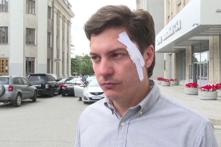 Вице-мэр Новосибирска Скатов показал травмы после задержания