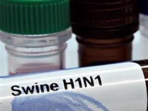 Две женщины скончались от «свиного» гриппа в Забайкалье 