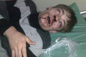 Новосибирский студент избит после матча «Сибири» с голландским ПСВ
